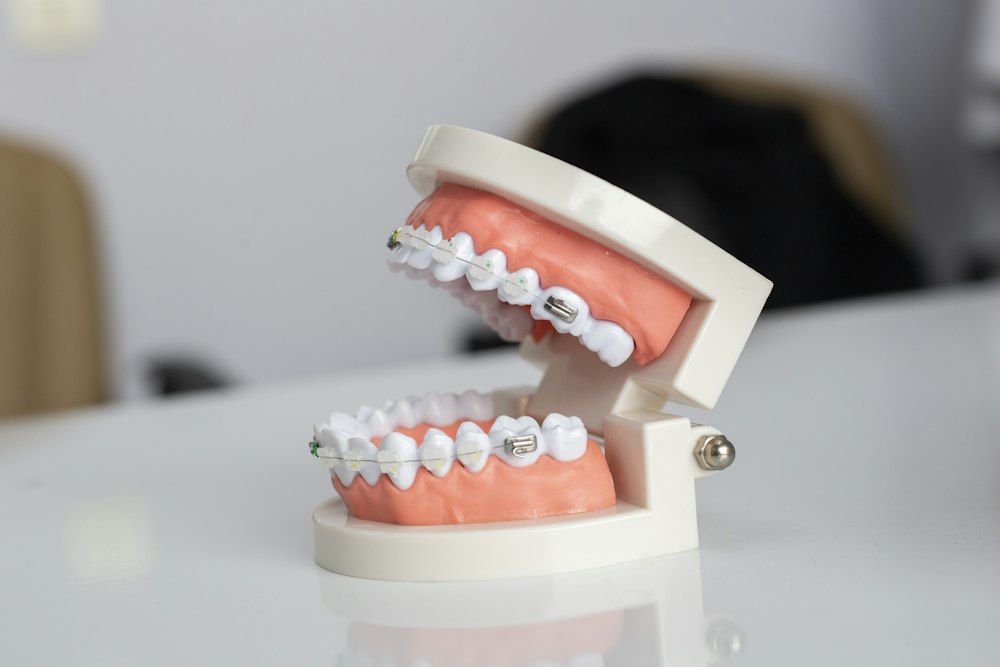 Modelo dental con brackets metálicos en su comuna