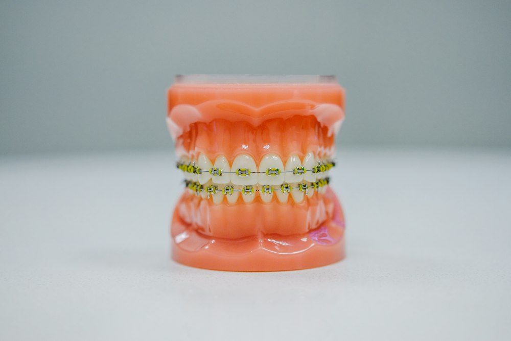 Modelo dental con brackets sobre fondo naranjo