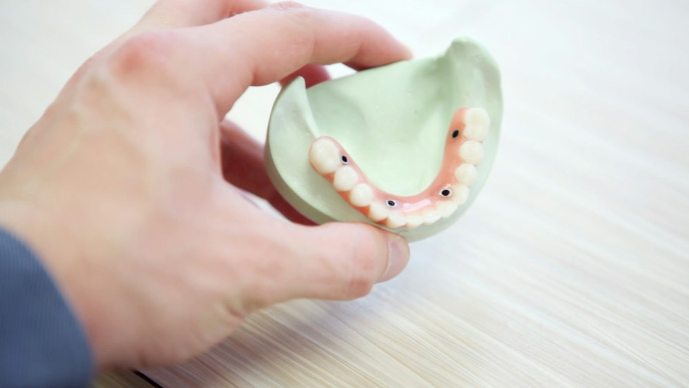 Modelo dental sostenido en una mano