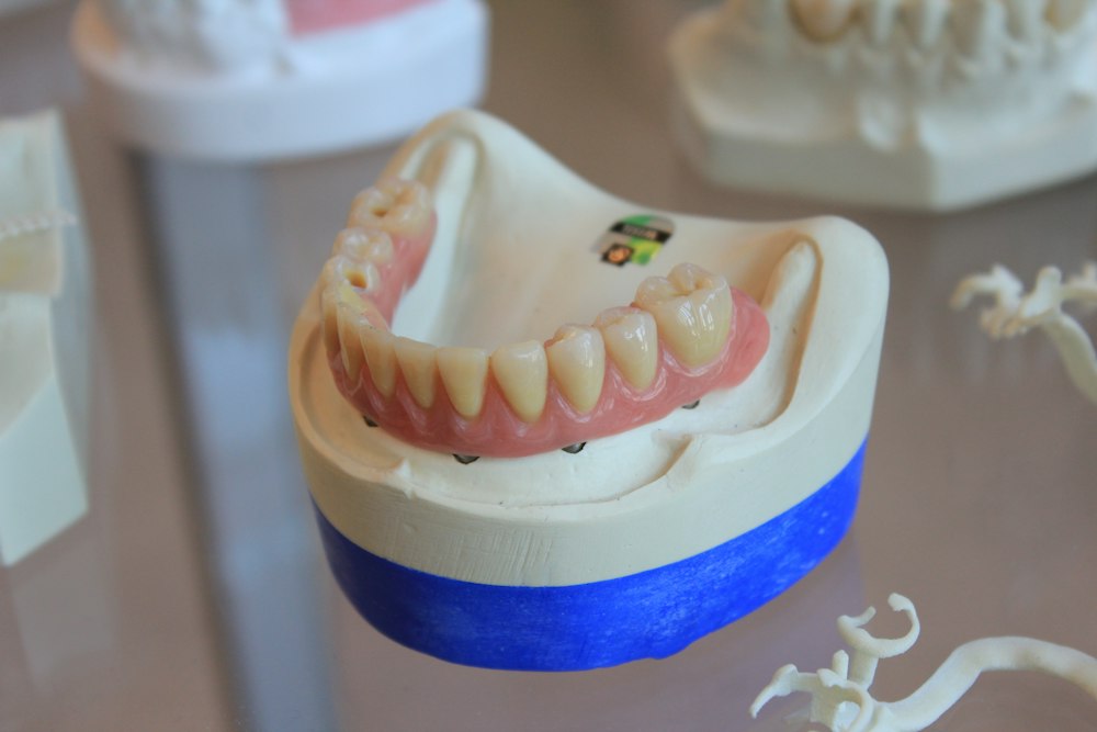 Prótesis dental sobre una repisa azul